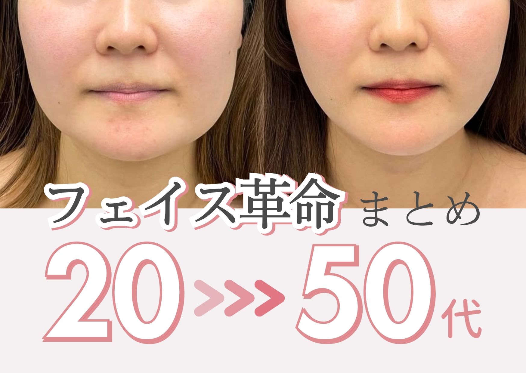 【小顔 症例集】新潟で小顔になるなら出口医師におまかせ｜脂肪吸引・糸リフト